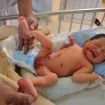 Trẻ sơ sinh đang được điều trị tại bệnh viện Dăc lắk